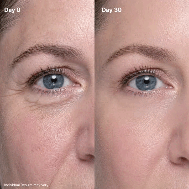 P7 Eye Renewal Cream