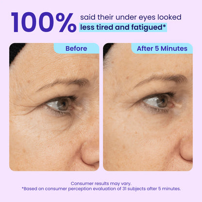 ✨New Arrivals✨ 𝙎𝙠𝙞𝙣𝙁𝙞𝙭𝙎𝙤𝙡𝙪𝙩𝙞𝙤𝙣𝙨® Instant Lift Eye Gel