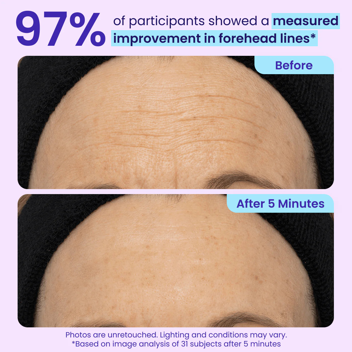 ✨New Arrivals✨ 𝙎𝙠𝙞𝙣𝙁𝙞𝙭𝙎𝙤𝙡𝙪𝙩𝙞𝙤𝙣𝙨® Instant Lift Eye Gel