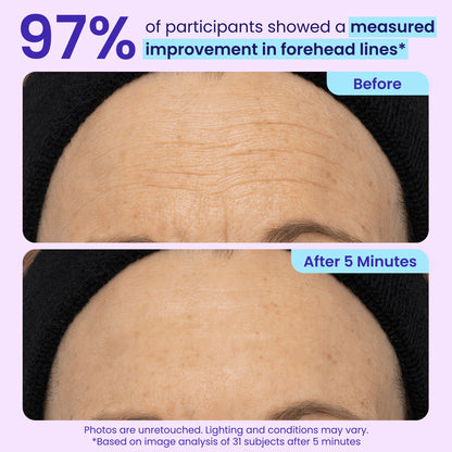 ✨New Arrivals✨ 𝙎𝙠𝙞𝙣𝙁𝙞𝙭𝙎𝙤𝙡𝙪𝙩𝙞𝙤𝙣𝙨® Instant Lift Eye Gel