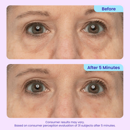 ✨New Arrivals✨ 𝙎𝙠𝙞𝙣𝙁𝙞𝙭𝙎𝙤𝙡𝙪𝙩𝙞𝙤𝙣𝙨® Instant Lift Eye Gel