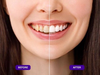 Dentley™ Purple Mouth Wash