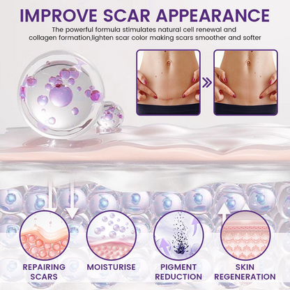 SkinFixSolutions® ReGenScar Stem Cell Scar Gel