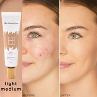 LIGHT-MEDIUM