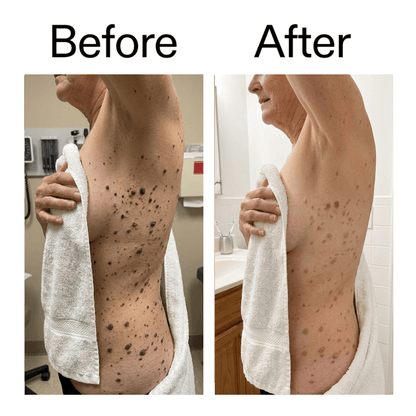 Smooth & Even Glycolic Body Stick - Equalize Labs